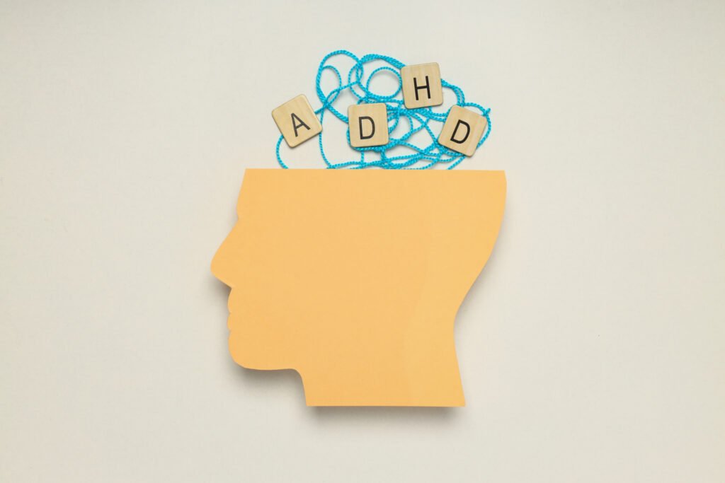 ADHD vs non ADHD brain